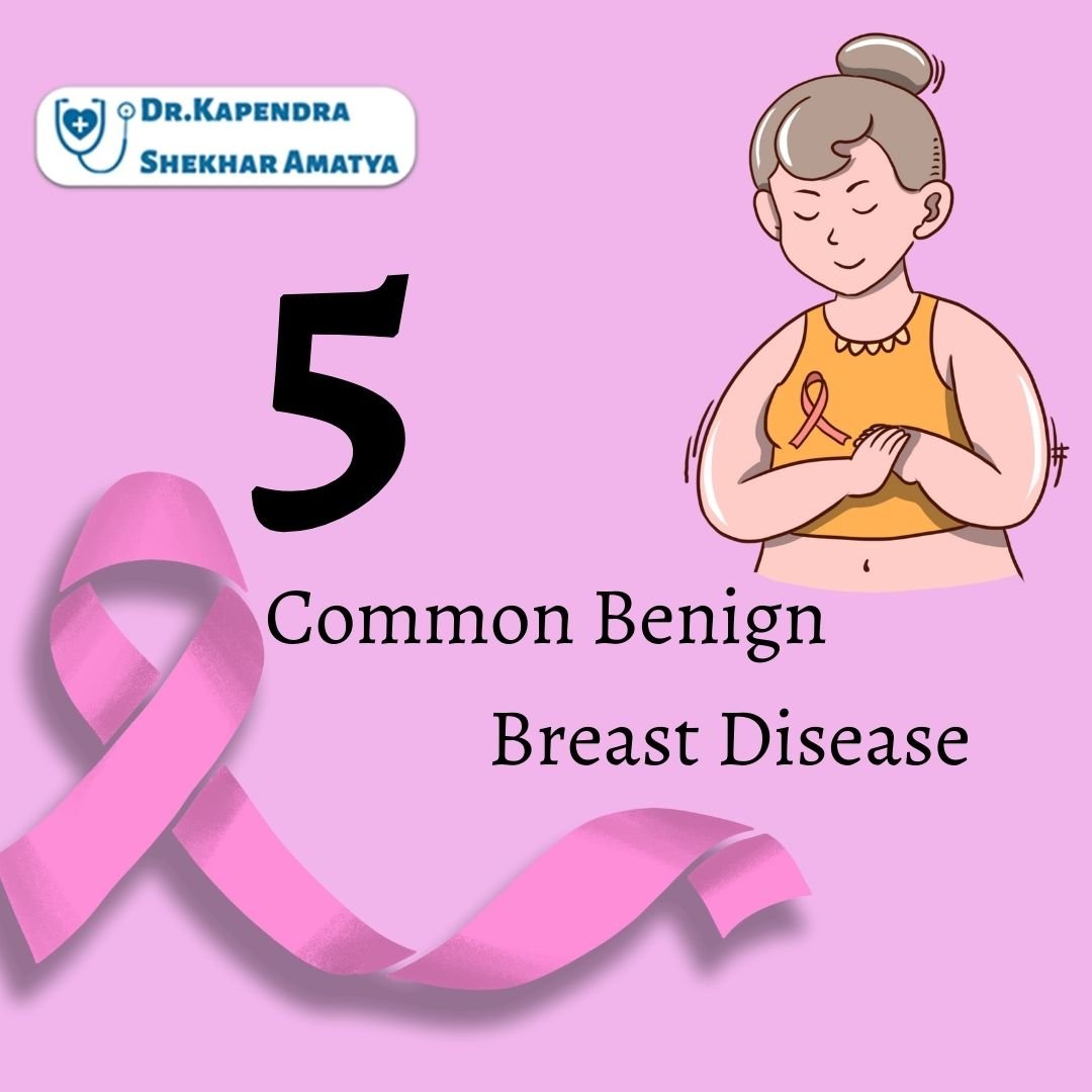 5 Common Benign Breast Disease
