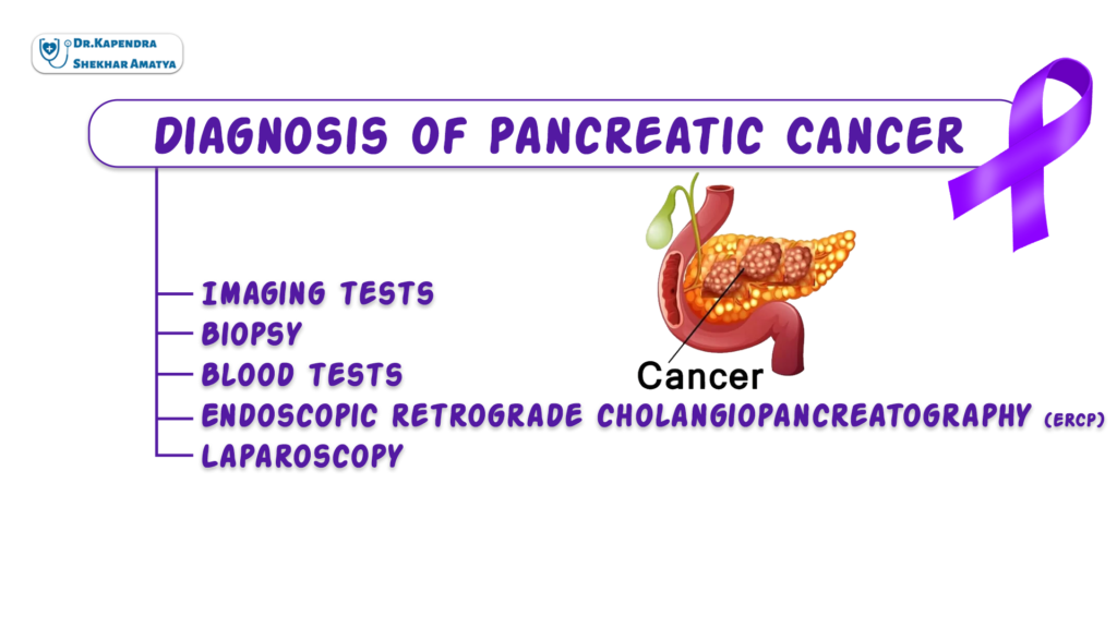 Diagnosis of Pancreatic Cancer