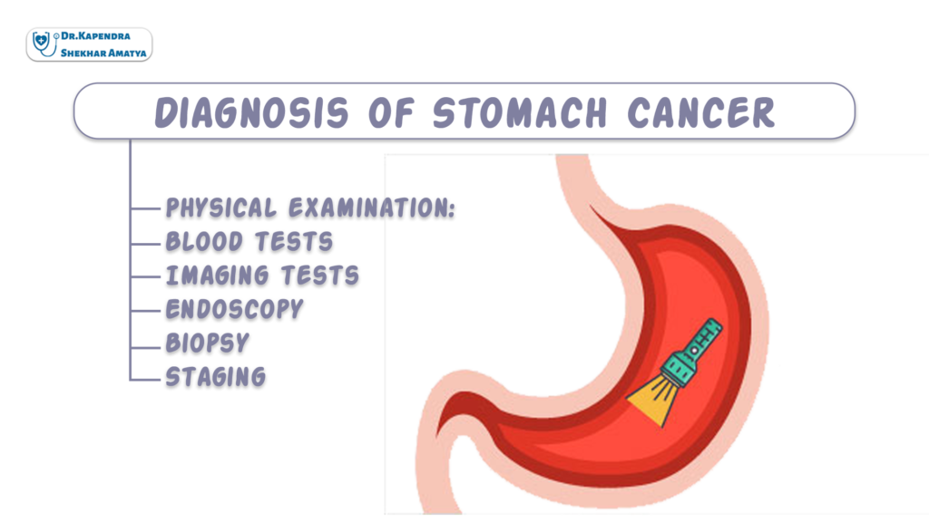 Diagnosis of Stomach Cancer: