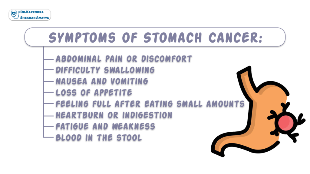 Symptoms of Stomach Cancer: