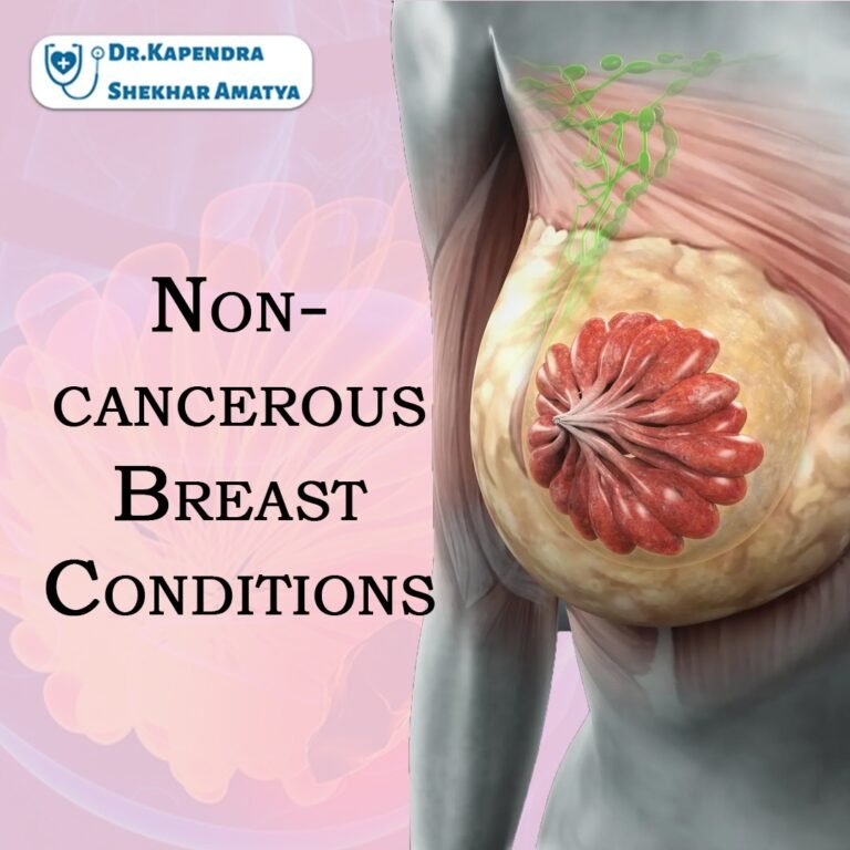 Things about Non-Cancerous Breast Conditions