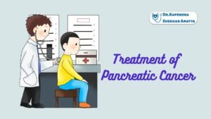 Treatment of Pancreatic Cancer