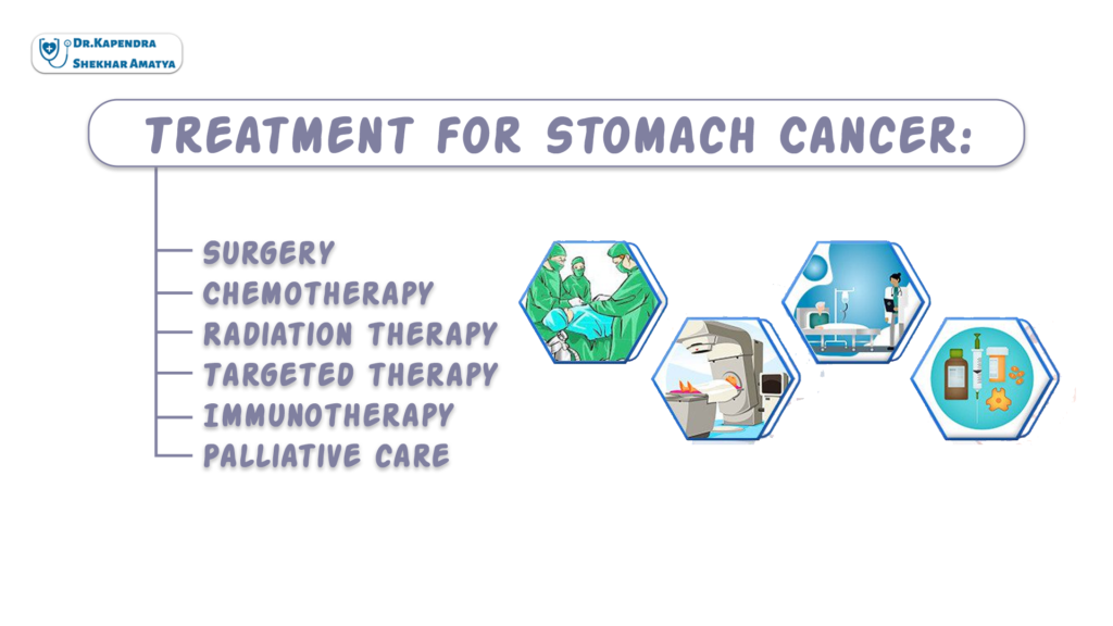Treatment for Stomach Cancer: