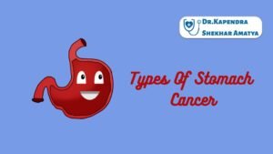Types Of Stomach Cancer
