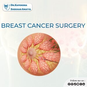 What is a Breast Cancer Surgery in Nepal