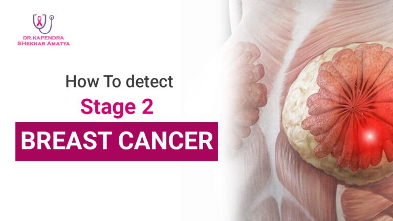 detect Stage 2 breast cancer