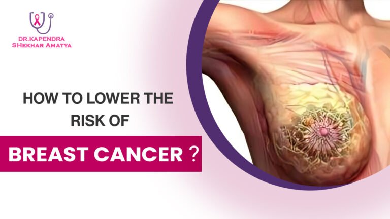 How to Lower the Risk of Breast Cancer